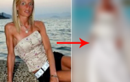 Når du ser hva som skjedde med disse folkene med spiseforstyrrelser, vil du bli sjokkert. Når du ser hva som skjedde med disse folkene med spiseforstyrrelser, vil du bli sjokkert.